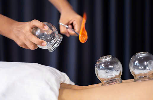 Top 6 Reasons to Try Cupping Therapy Massage Today