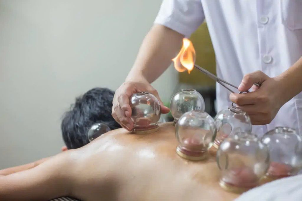 Top 6 Reasons to Try Cupping Therapy Massage Today