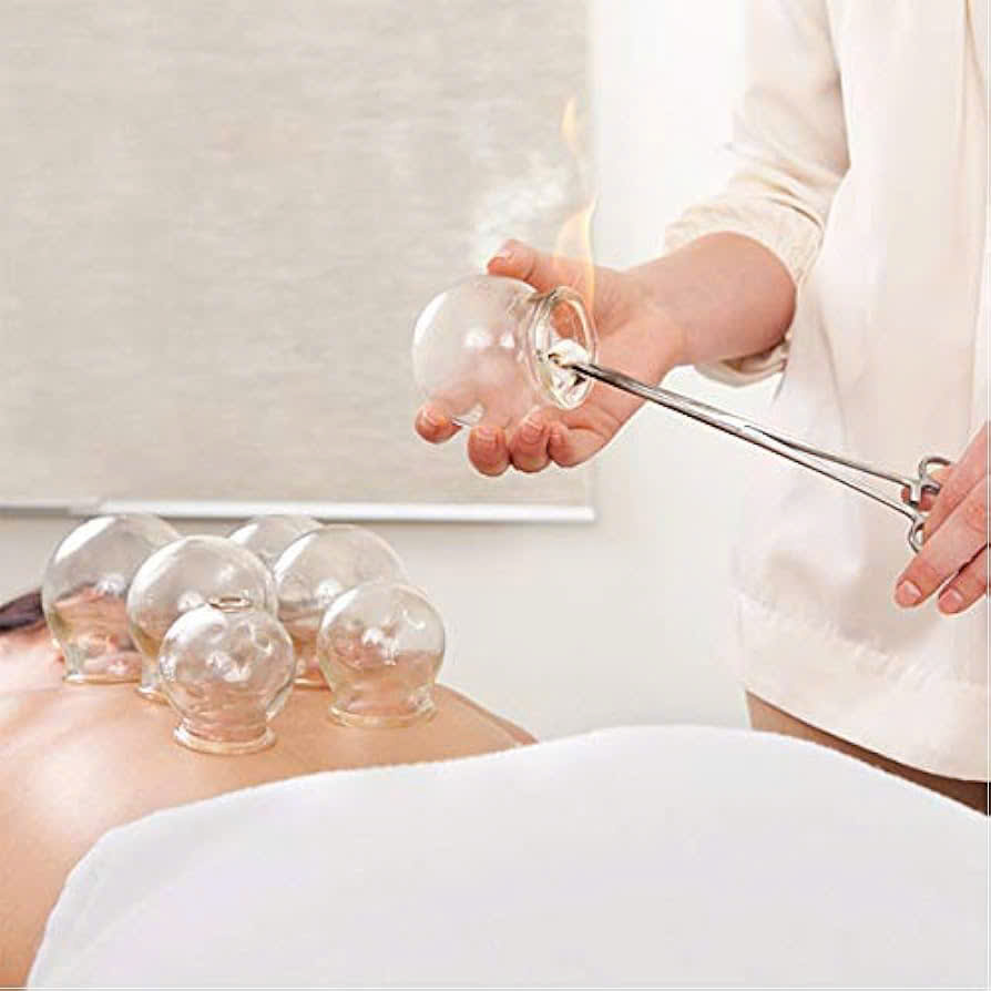 Top 6 Reasons to Try Cupping Therapy Massage Today